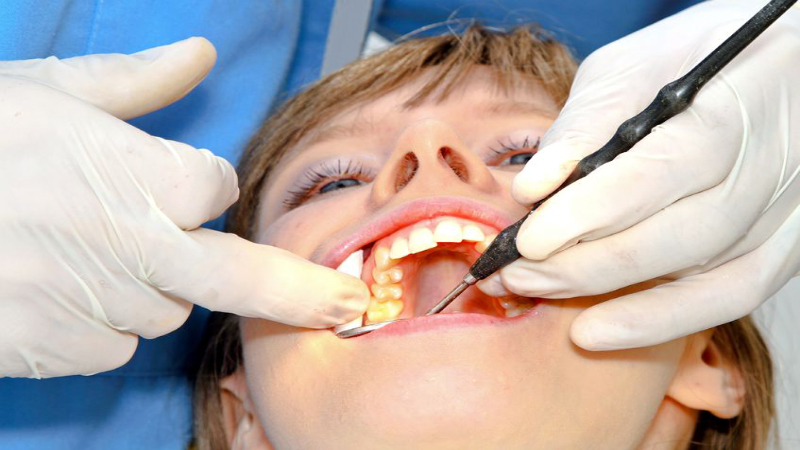 How Sedation Dentistry Eases Stress