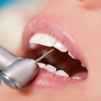 A Dentist In Itasca Can Help You Live Better