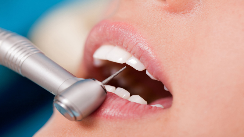 A Dentist In Itasca Can Help You Live Better