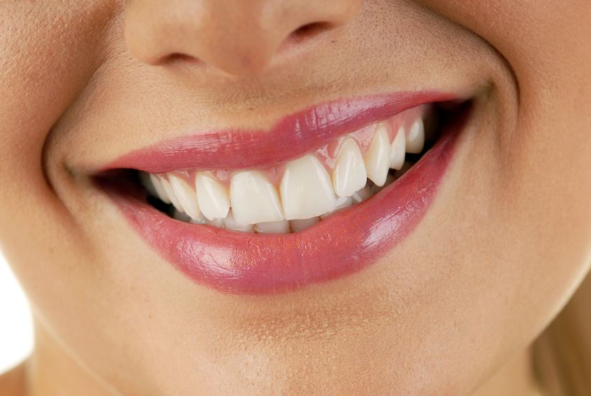 Dentist in Heber Springs-The Best Way to Keep Your Smile Beautiful