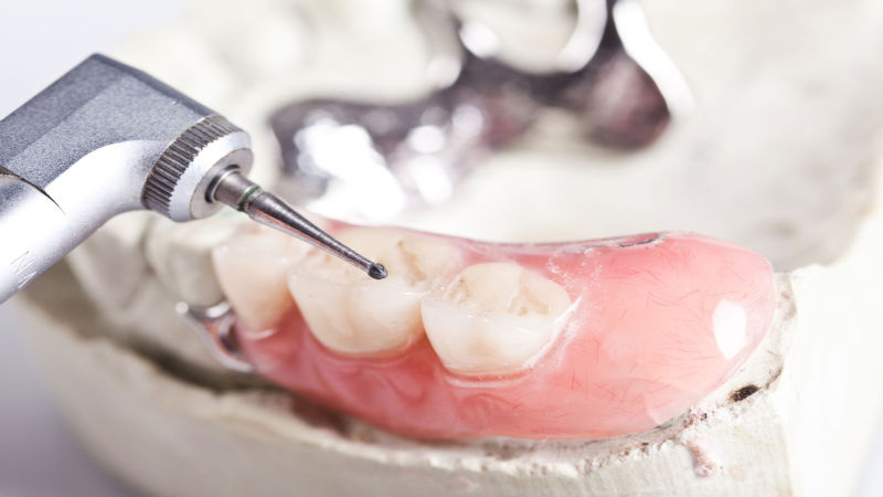 Facts About Dental Root Canals in Salem OR