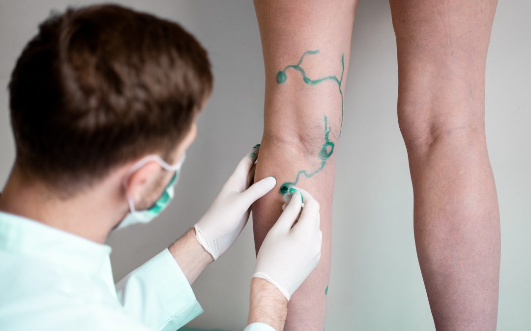Finding the Right Vein Clinic in Schaumburg for Lasting Relief