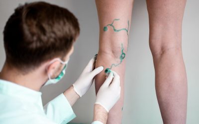 Finding the Right Vein Clinic in Schaumburg for Lasting Relief